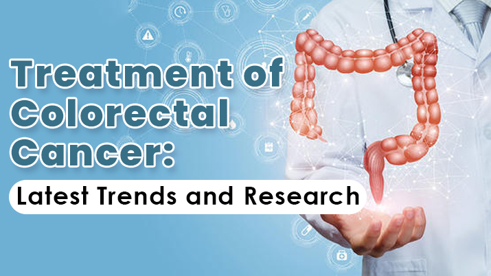 You are currently viewing Treatment of Colorectal Cancer: Latest Trends and Research
