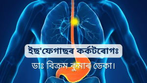 Read more about the article ইছ’ফেগাছৰ কৰ্কটৰোগঃ ডাঃ বিক্ৰম কুমাৰ ডেকা।