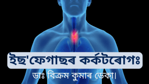 Read more about the article ইছ’ফেগাছৰ কৰ্কটৰোগঃ – ডাঃ বিক্ৰম কুমাৰ ডেকা।